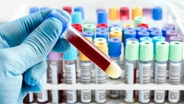 PDW yüksekliği nedir? (PDW kan değeri ne kadar olmalı?)