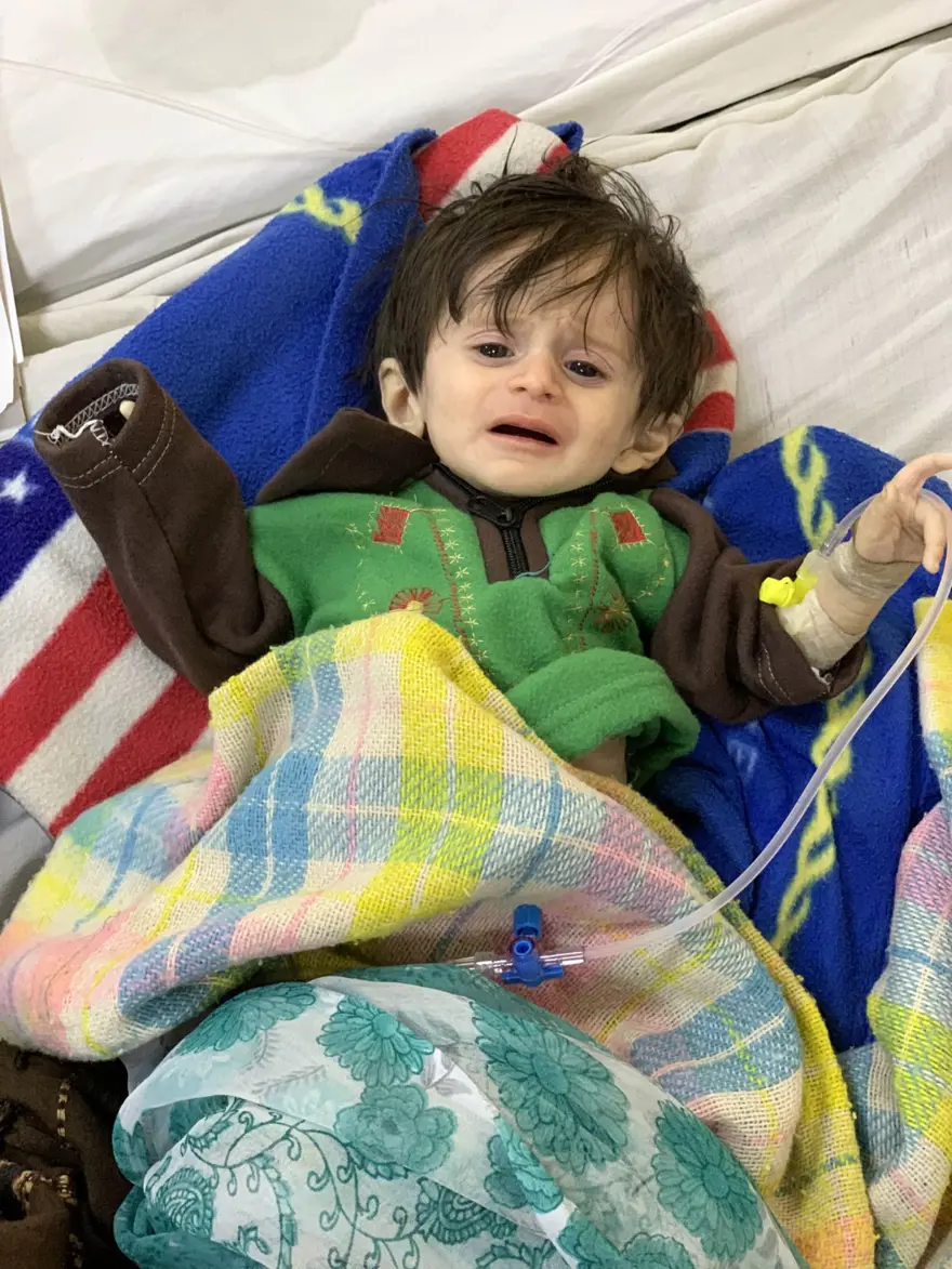 İnsanlık dramı: Sütten kesilen Afgan annelerin bebekleri büyüyemiyor 2 İnsanlık dramı: Sütten kesilen Afgan annelerin bebekleri büyüyemiyor 2