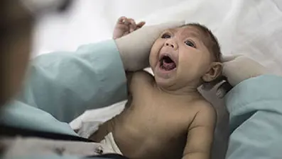 Doğu Karadeniz'de Zika virüsü alarmı