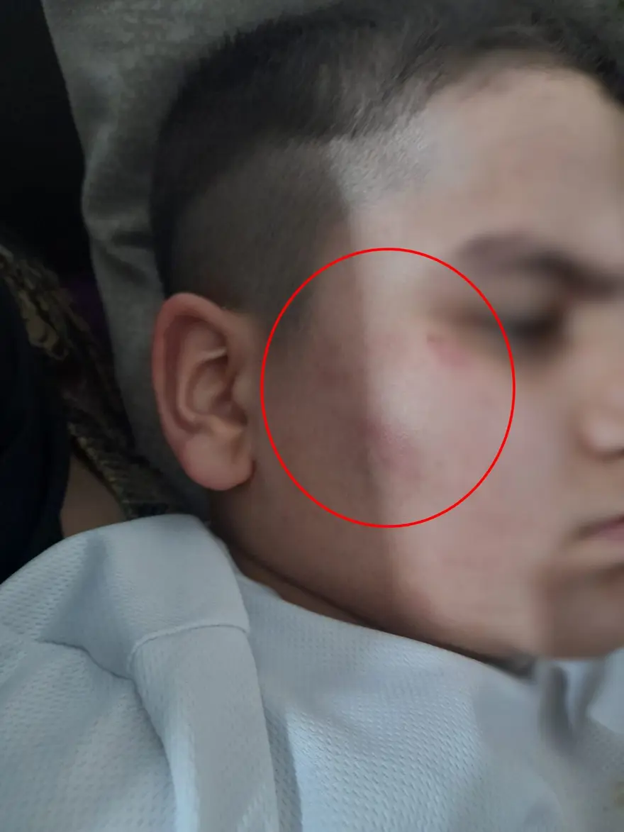 Otizmli çocuğa okulda dayak iddiası 4