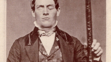 Büyük tıbbi gizem: Kafasına demir çubuk saplanmasına rağmen hayatta kalan adam