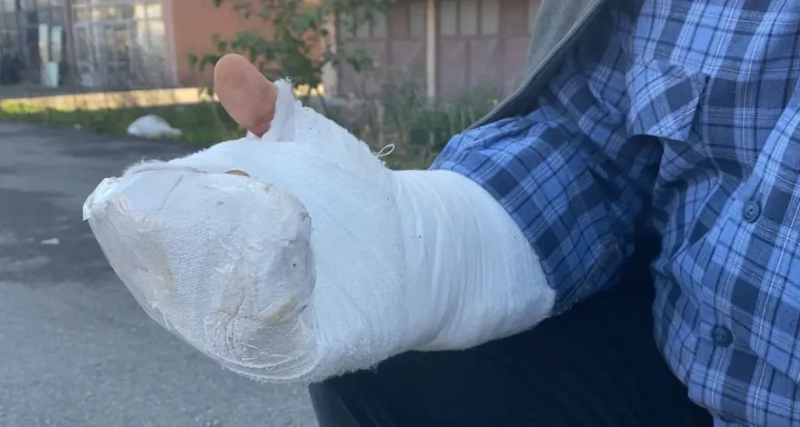 Aynı taşa 6 kez takılıp düşerek ölümden döndü 1 Aynı taşa 6 kez takılıp düşerek ölümden döndü 1