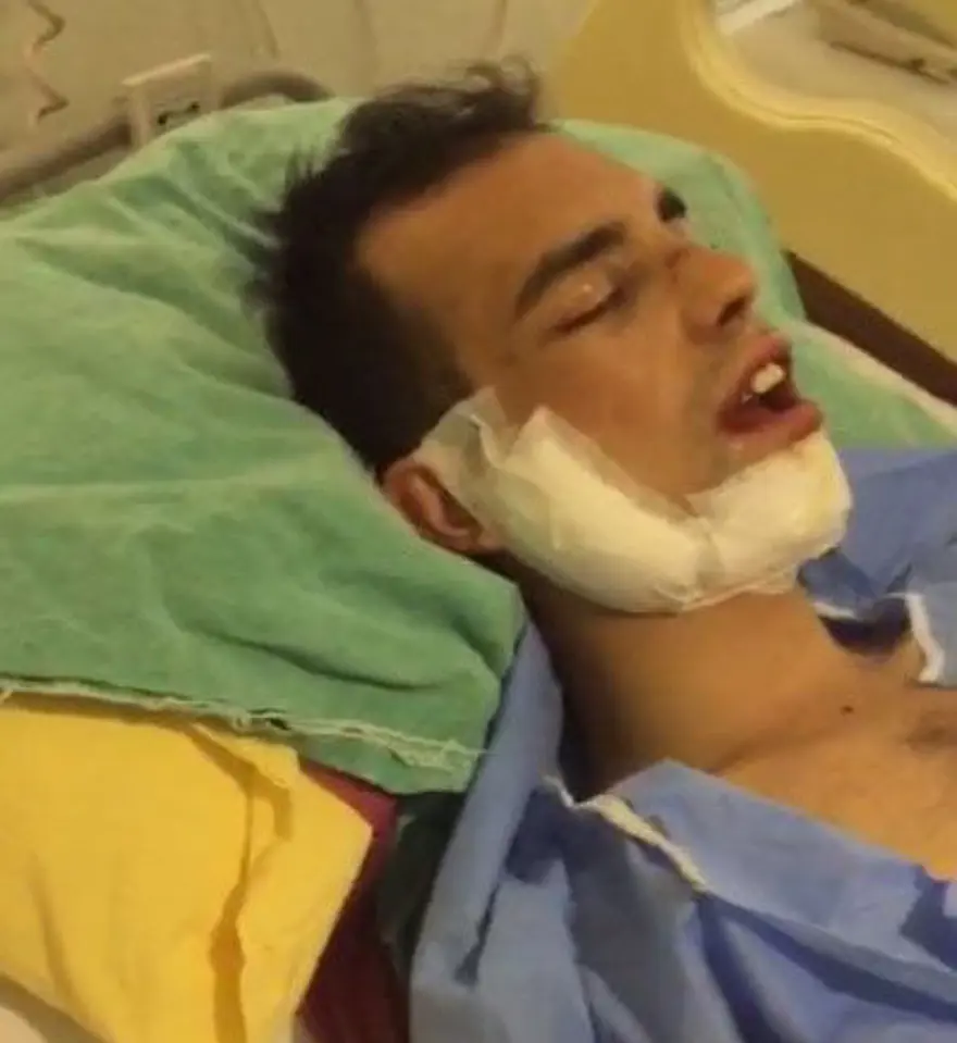 Veteriner hekime saldırı iddiası (Çenesinde ve vücudundakırıklar var) 2 Veteriner hekime saldırı iddiası (Çenesinde ve vücudundakırıklar var) 2