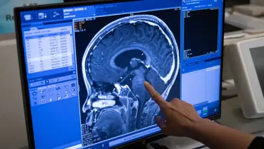 Cinsiyet ayrımcılığı araştırması: Beynin bazı bölümlerini inceltebiliyor