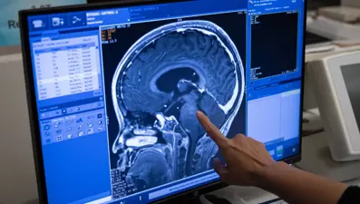 Cinsiyet ayrımcılığı araştırması: Beynin bazı bölümlerini inceltebiliyor