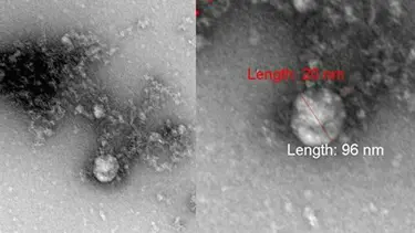 Prof. Dr. Karadenizli: Covid-19 şimdiye kadar yaklaşık 5 bin mutasyon geçirmiştir