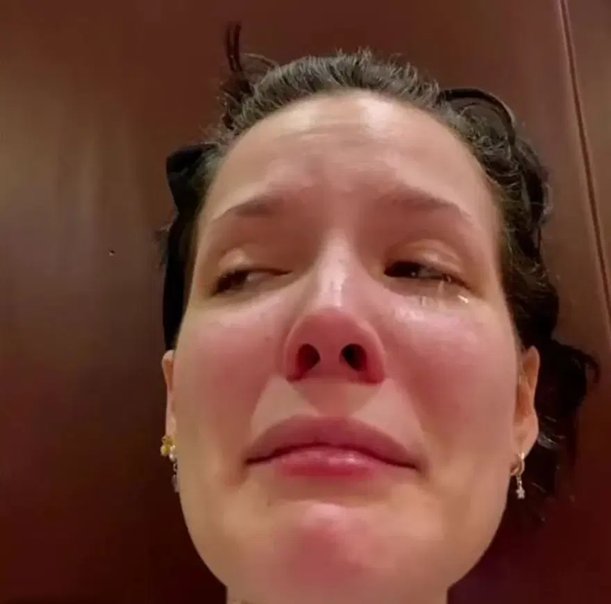 Halsey hastalığını paylaştı: Yaşlı bir kadın gibi hissediyorum 4