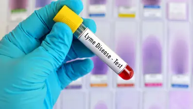 “Lyme hastalığı için klinik açılmalı” (Lyme hastalığı nedir, nasıl tedavi edilir?)