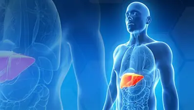 Karaciğerin sinsi hastalığı: NASH (Türkiye’de 4 milyon NASH hastası var)