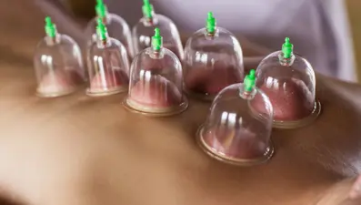 Hacamat ve akupunktur merdiven altından kurtarılıyor!