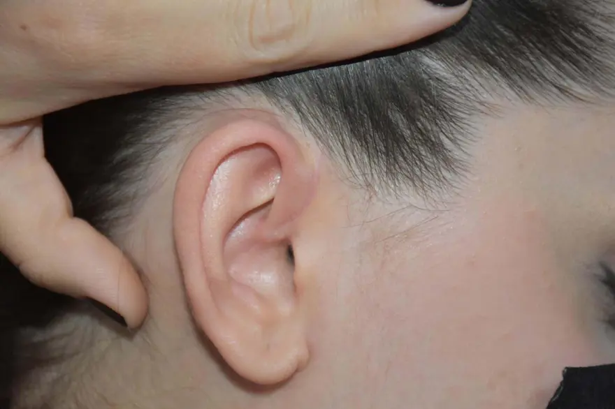 SALDIRGAN BİR GÜN SONRA YAKALANDI 3