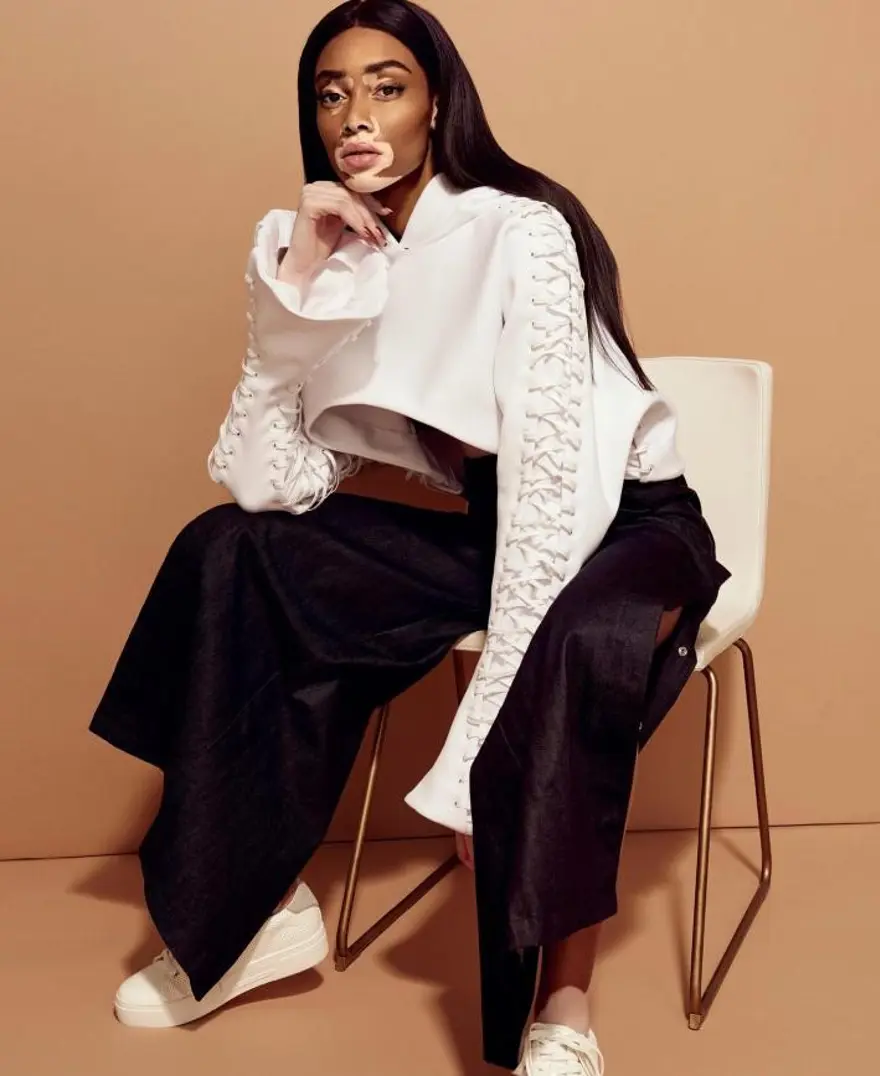 Vitiligolu model Winnie Harlow: Sizin gibi beynim ve iskeletim var 