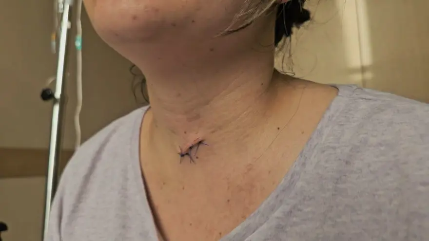 "BAŞIMDA ÖLMEMİ BEKLEDİ" 5