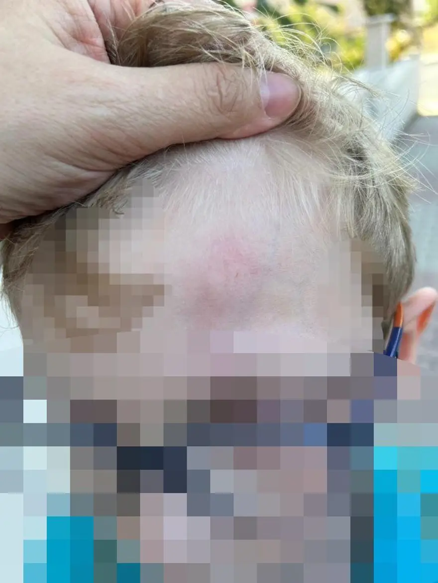 Beylikdüzü’nde okuldademir çubuklu dayak iddiası: Kafası şişti, kollarında kızarıklıklar oluştu 1