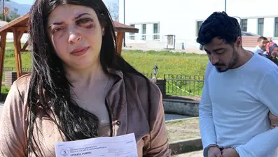 Sokak ortasında tacize uğrayıp dayak yiyen Damla'nın isyanı