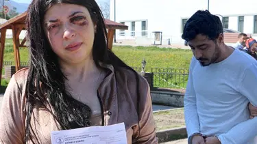 Sokak ortasında tacize uğrayıp dayak yiyen Damla'nın isyanı