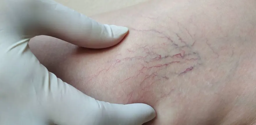 Varis hastaları oruç tutabilir mi? Diyanet'e göre varis hastaları oruç tutabilir mi? 