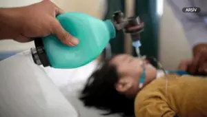 ABD'de kızamık görülen eyalet sayısı 28'e çıktı (Vaka sayısı bin 22)