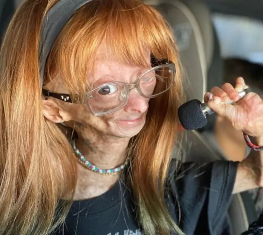 4 milyonda 1 görülüyor: Bu hastalığa yakalanan en fazla 20 yıl hayatta kalabiliyor 4 4 milyonda 1 görülüyor: Bu hastalığa yakalanan en fazla 20 yıl hayatta kalabiliyor 4