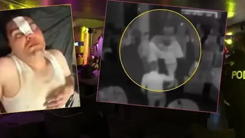 Çerezi beraber, dayağı tek yedi. 13 bin 500 liralık hesaba itiraz etti, öldüresiye dövüldü