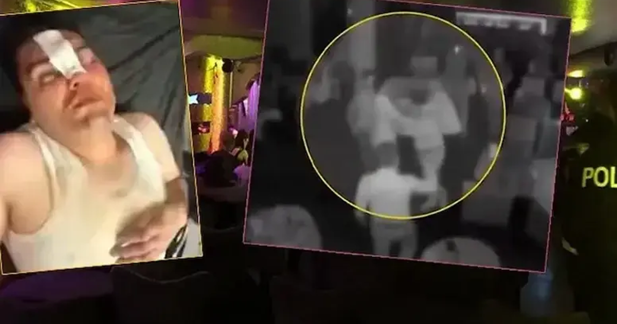 Çerezi beraber, dayağı tek yedi. 13 bin 500 liralık hesaba itiraz etti, öldüresiye dövüldü