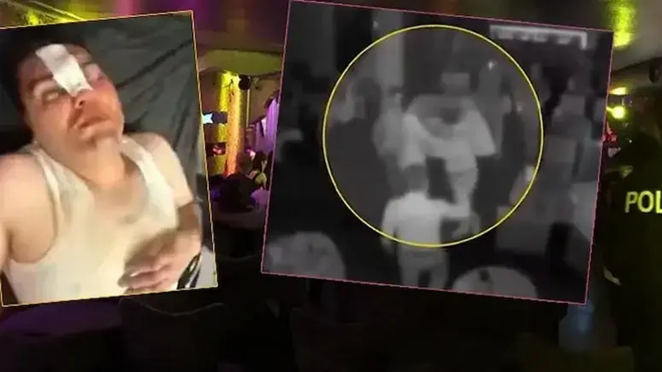 Çerezi beraber, dayağı tek yedi. 13 bin 500 liralık hesaba itiraz etti, öldüresiye dövüldü