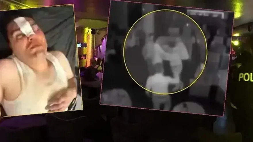 Çerezi beraber, dayağı tek yedi. 13 bin 500 liralık hesaba itiraz etti, öldüresiye dövüldü 