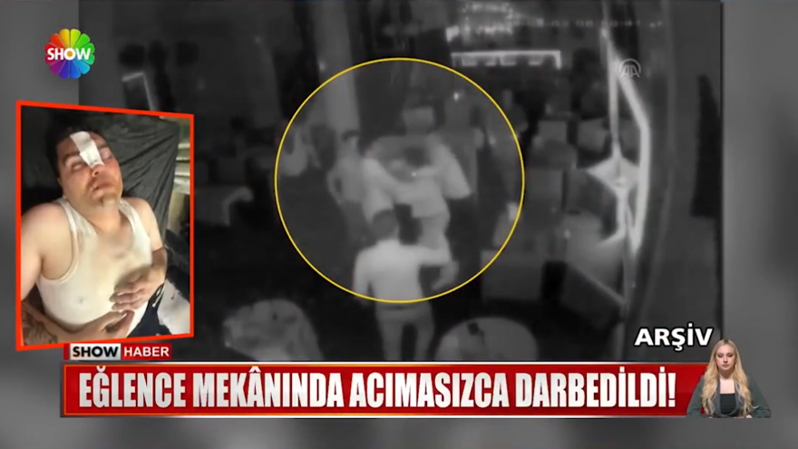 Çerezi beraber, dayağı tek yedi. 13 bin 500 liralık hesaba itiraz etti, öldüresiye dövüldü 2