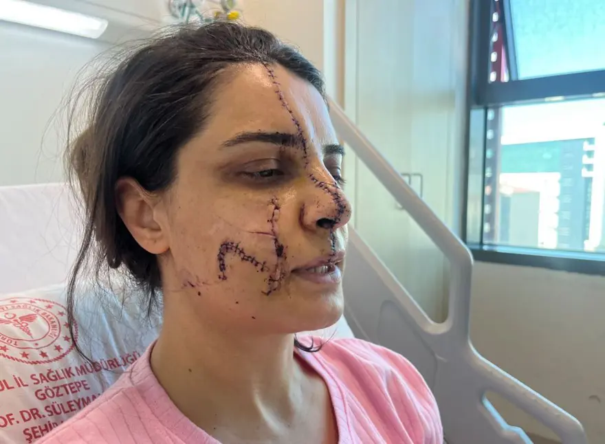 Marmaray saldırganından ağaçta taciz: Saldırıdan öncedefalarca evin önüne gelmiş 2