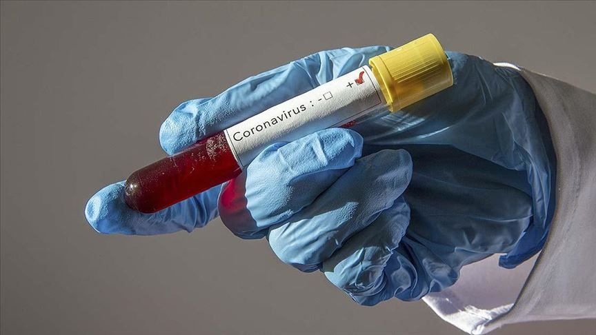 ABD'de yaşayan Türk çift, corona virüs test kiti üretti