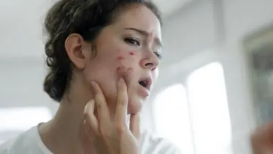 Karaciğer kanseri işareti olabilir: Uzmanı ciltte ortaya çıkan belirtilerini açıkladı