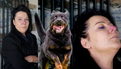 Bursa'da rottweiler saldırısı: Arkadaşının köpeği burnunu parçaladı