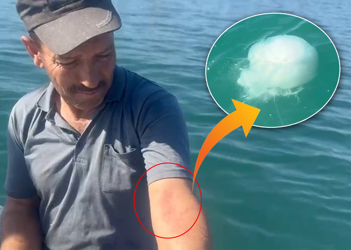 Körfezi zehirli denizanası sardı: Dokunanı yakıyor!