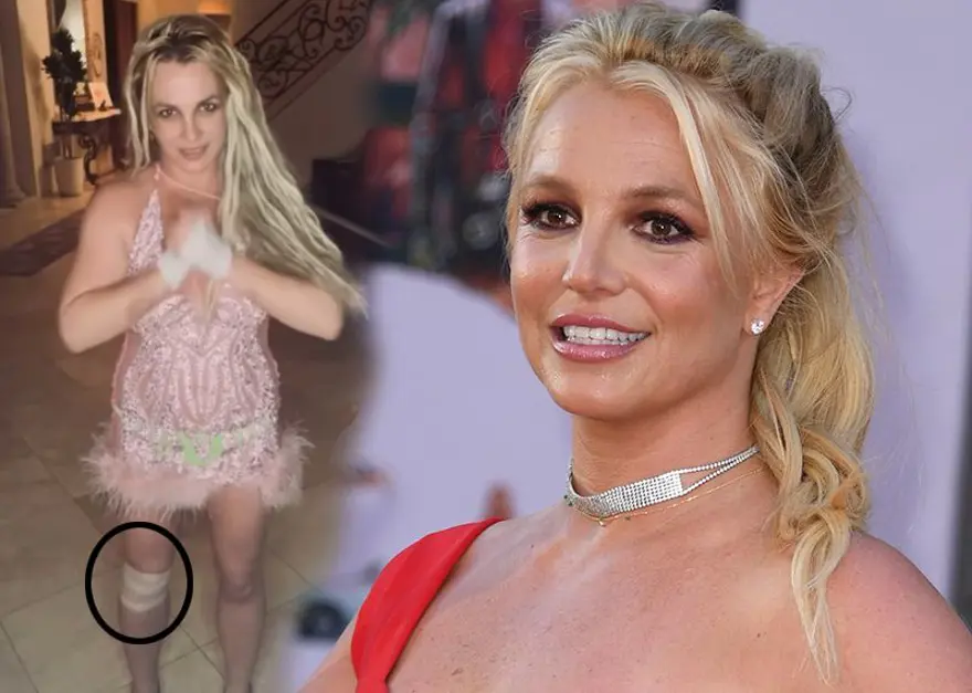 Britney Spears merdivenden düştü: Korkunçtu 