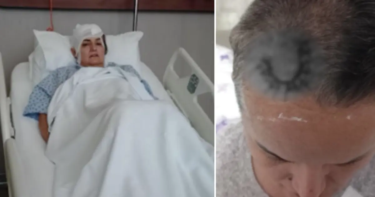 Diş ağrısı için gitti hayatı karardı. Şimdi beyninde ömür boyu cihazla yaşayacak