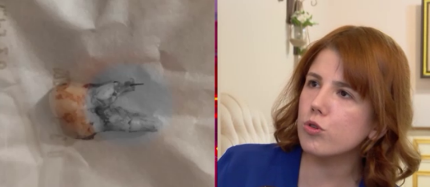 Kanal tedavisi yaptırdı, hayatı kabusa döndü: "İki yıl paslı demirle yaşamışım" 3