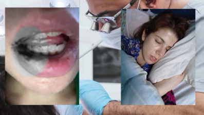 Kanal tedavisi yaptırdı, hayatı kabusa döndü: "İki yıl paslı demirle yaşamışım"