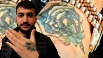 Dövmesini sildirmek istedi, elinden oluyordu