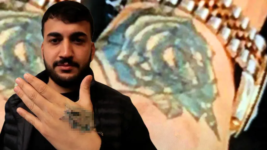 Dövmesini sildirmek istedi, elinden oluyordu 