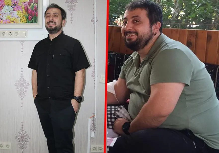 126 kiloydu, 2 yılda 40 kilo verdi: "Gören mide küçültme ameliyatı mı oldun" diyor 