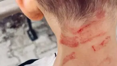 Rehabilitasyon merkezinde 5 yaşında çocuğa şiddet iddiası