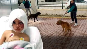 Pitbull saldırısının görüntülerini silmeye çalıştılar Pitbull saldırısının görüntülerini silmeye çalıştılar