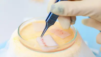 Yeni Zelanda'da yanardağ kurbanlarına deri nakli yapılıyor