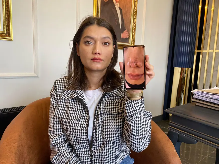 "ÜCRET KABUL ETMİYORSA HATASINI KABUL ETMİŞ OLUR" 3 "ÜCRET KABUL ETMİYORSA HATASINI KABUL ETMİŞ OLUR" 3