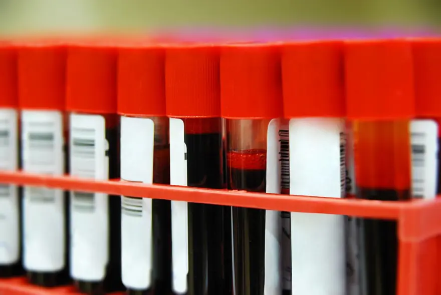 Araştırma: Kan grupları sağlığa dair ipuçları verebilir 5