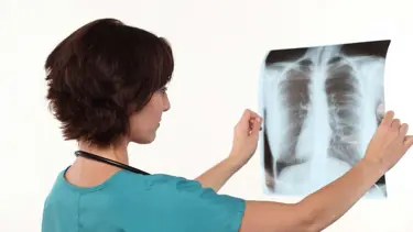 Verem hastalığının 8 belirtisine dikkat! (1-7 Ocak Verem Savaş Haftası)