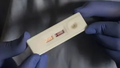 HIV'de umut veren ilaç