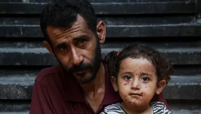 Gazze'nin çocuk kurbanları: Savaş, hastalık ve çaresizlik