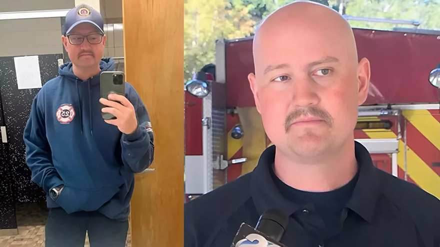 Milyonda 2 kişide görülüyor: Grip oldu, burnunu kaybetti 