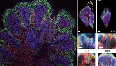 Cambridge Üniversitesi'nden demans ve felce karşı önemli adım: Laboratuvarda mini beyinler geliştirildi